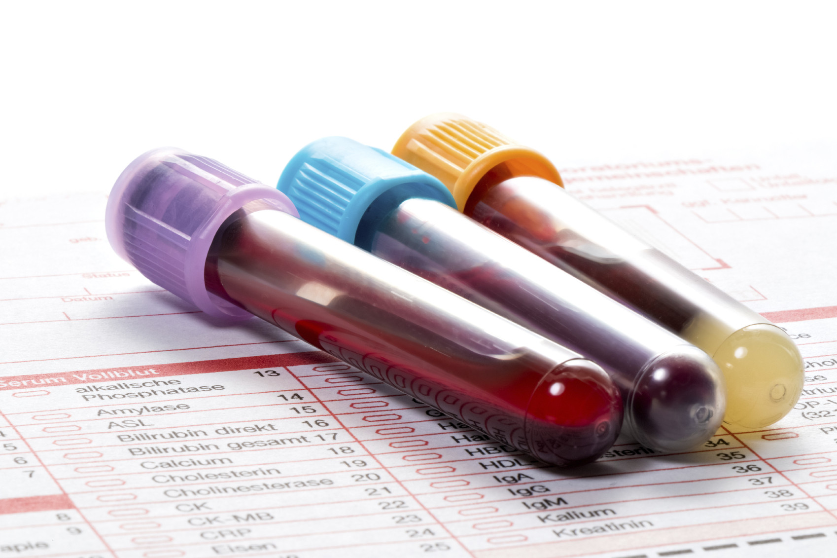 Short-Term Effects on Blood Test Results